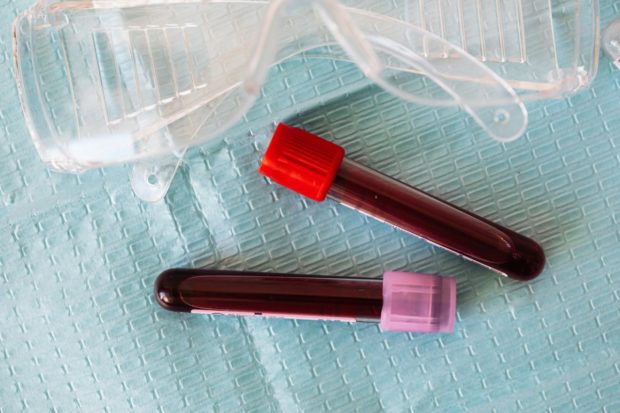 Čeští experti na zhoubné nádory krve přijímají první pacienty z Ukrajiny