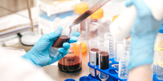 Léčba hemofilie je vysoce nákladná, ale cena života je ještě vyšší